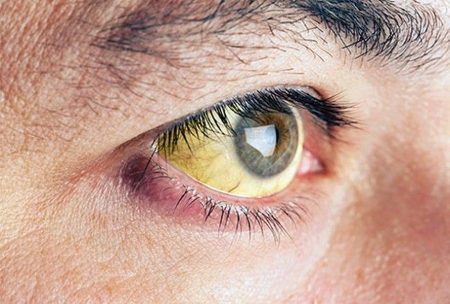 6 Ciri Kondisi Mata yang Tidak Sehat